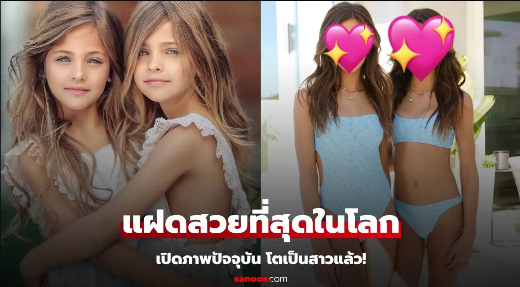 จำได้ไหม? “ฝาแฝดสวยที่สุดในโลก” ทำโซเชียลแตกเมื่อ 7 ปีก่อน ปัจจุบันโตเป็นสาวแล้ว!